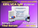 EVB,VCA-IgM ELISA kit