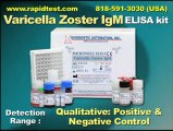 Varicella Zoster IgM ELISA kit