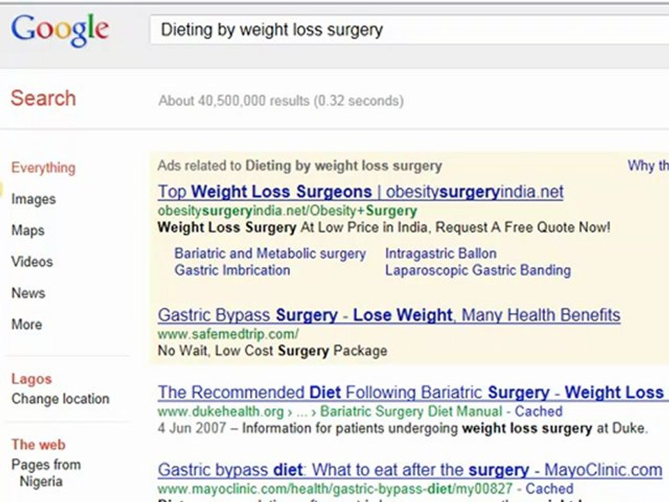 Dieting by weight loss surgery