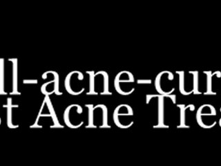 The Best Acne ToolKit For Beautiful Skin. Get Rid Of Acne Treatment!