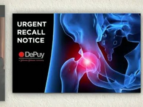Our Depuy Hip Recall Lawyer can be of great help!