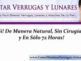 verrugas en el cuello - verrugas planas - eliminar verrugas