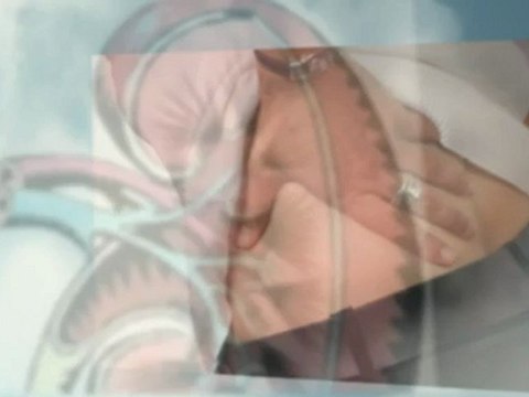 Diet Tips for Kidney Disease