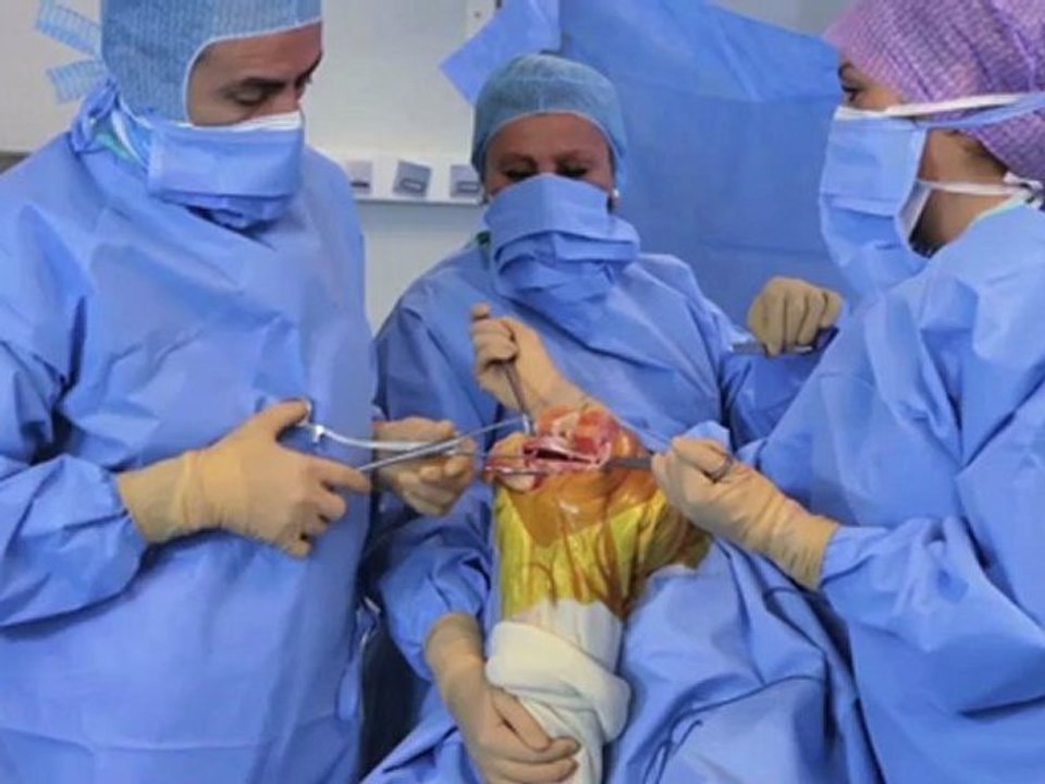 Prothèse totale de genou MyKnee lefevre bohu herman
