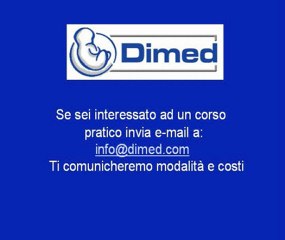 Metodologia per lo studio della scansione tre vasi - arco aortico