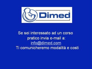 Ventricolo destro a doppia uscita