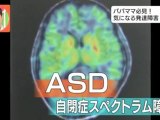 大人の発達障害 ASD自閉症スペクトラム障害　新しい診断方法？