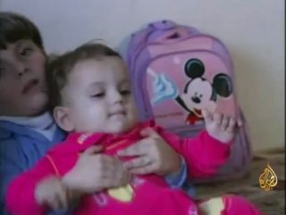 جرّاح إماراتي يتمكن من إعادة السمع لأطفال فلسطينيين