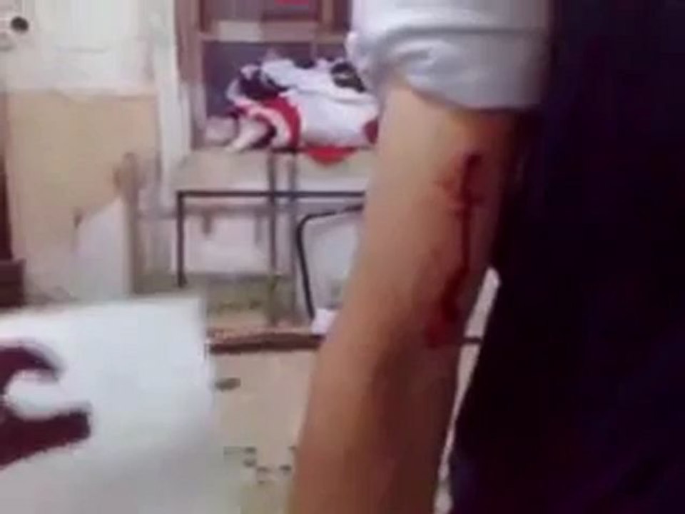 Syria فري برس  ريف دمشق عربين  هااام للاعلام اصابات جراء القصف    22 5 2012  ج1 Damascus