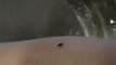 Pictures of Bed Bugs | Images of Bed Bugs | Bedbug Looking to Feed