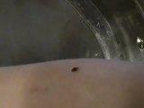 Pictures of Bed Bugs | Images of Bed Bugs | Bedbug Looking to Feed