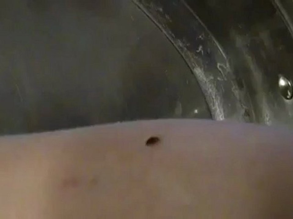 Pictures of Bed Bugs | Images of Bed Bugs | Bedbug Looking to Feed