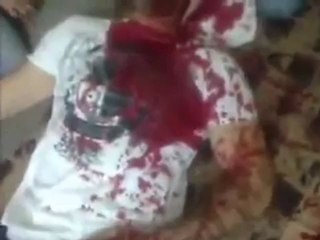 Syria فري برس  حماه المحتلةالشهيد قصي اليوسف بطل جامعةحلب مصاب بطلقة قناص بحمص17 5  202 Hama