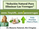 Como eliminar las verrugas | Como quitar verrugas naturalmente