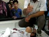 Syria فري برس حمص  الحولة اصابة احد المدنيين نتيجة القصف العشوائي 25 2 2012 Homs