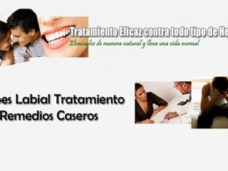 Herpes Labial Tratamiento