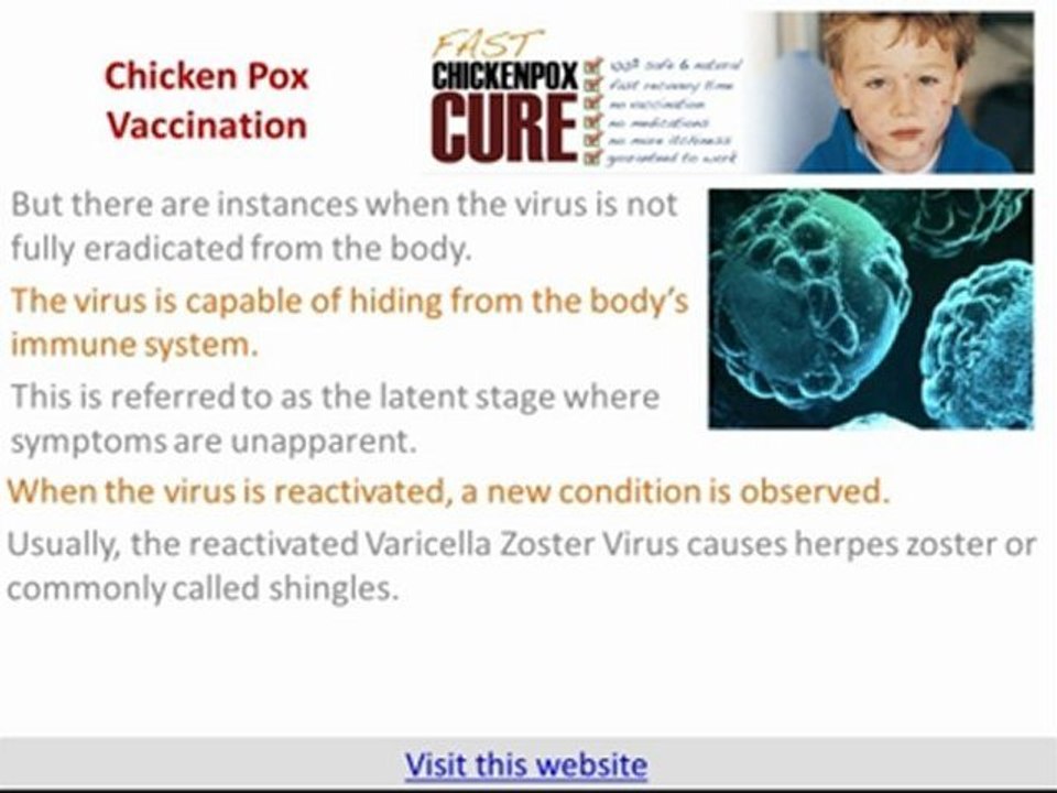 Chicken Pox Vaccination