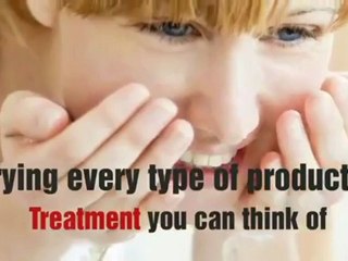 Natural ways to get rid of acne