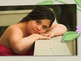 Down Syndrome -- Facts and Its Definition