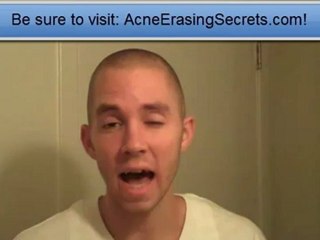 Apple Cider Vinegar Acne