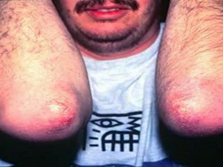 arthritis and knee pain - knee pain from arthritis - knee pain and arthritis