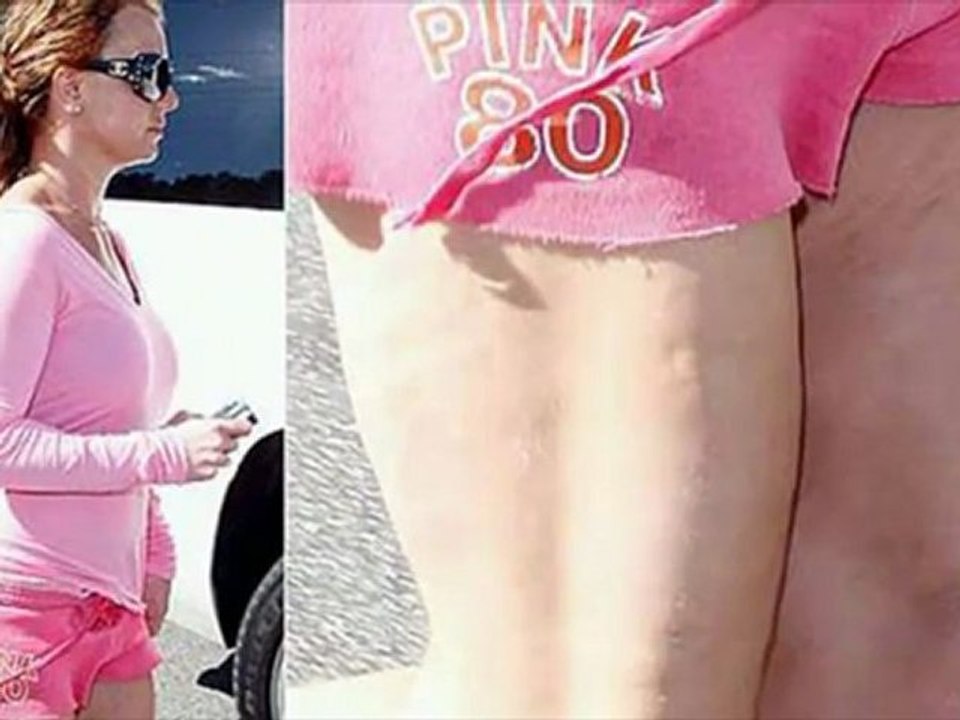 Tips Cellulite - [Che cos'è la cellulite e come combattere]