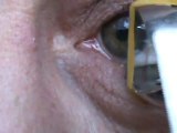 Eyepopping : faire sortir son globe oculaire de l'orbite
