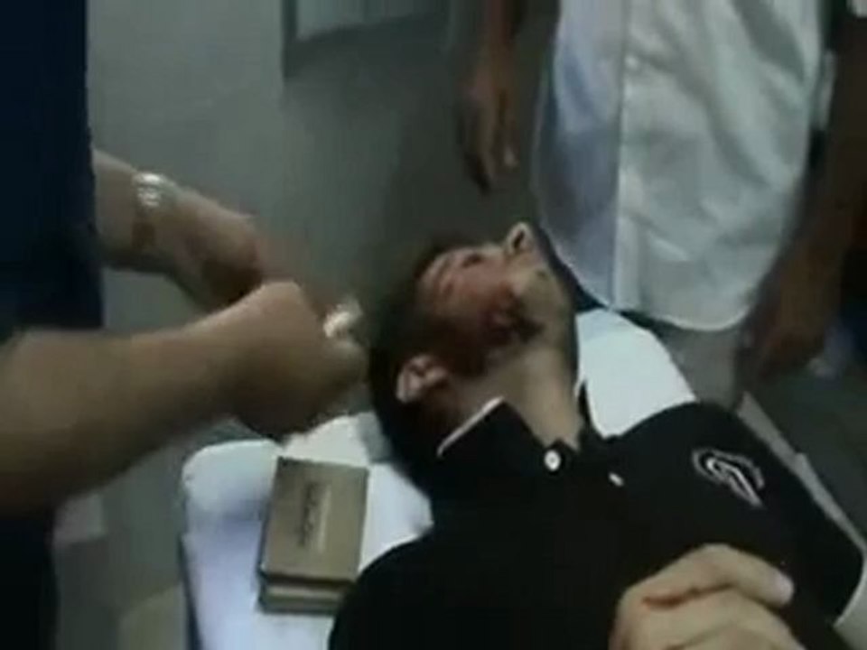 Syria فري برس حمص الحولة اصابة احد المدنين جراء القصف العشوائي30 5 2012 Homs