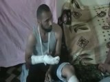 Syria فري برس حمص  الحولة لقاء مع احد المصابين الناجين من مجزرة الحولة 30 5 2012 Homs