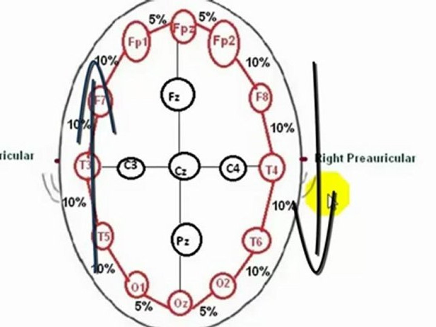 Eeg Electrode Placement 10 20 System