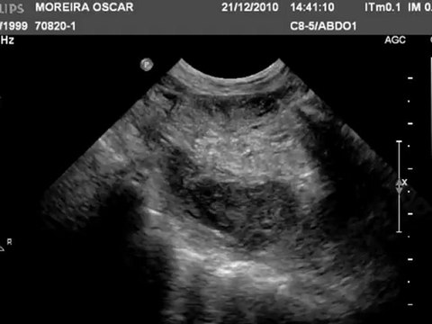 colon lsk nl-70820-1_a-clean