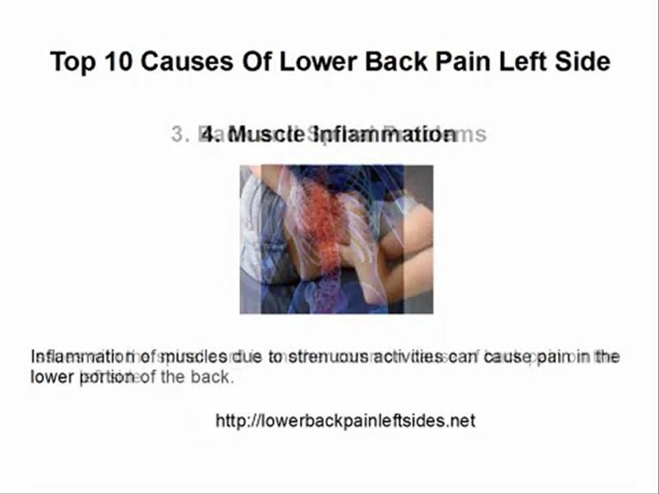 Lower Back Pain Left Side - Top 10 Reasons
