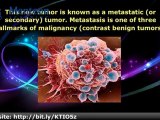 Metastasis - College Biology