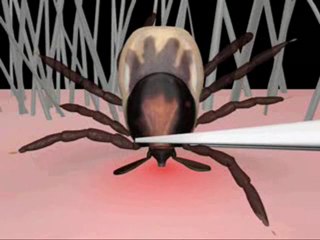 Kene Nasıl Çıkarılır Animasyonu ~ bodytr.com