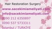 Hair Transplant,Hair Replacement,Hair Transplantation,Hair Transplant,Hair Replacement,Hair Transplantation