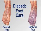 Diabetic Foot Care - Podiatrist - Chicago, Six Corners and Northwest Side