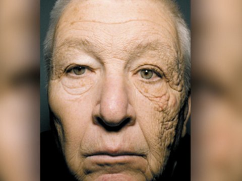 Il vieillit plus vite à cause de son travail..