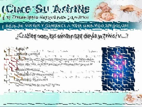 Que es la artritis reumatoide - Como Curar La Artritis