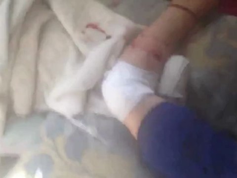 Syria فري برس اللاذقية اصابات في مدينة الحفة نتيجة قصف عصابات الأسد الغاشم Latakia