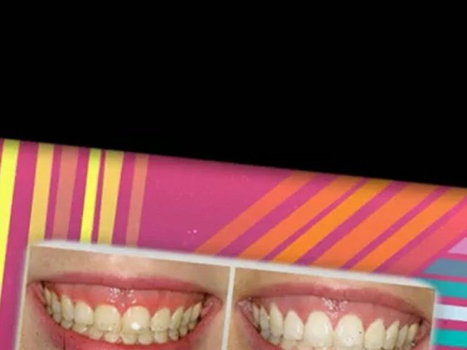Dental Implants Seattle