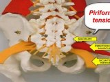 pain management for sciatica - exercises for sciatica pain - sciatica and leg pain