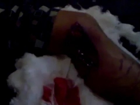 Syria فري برس ريف دمشق ثوار الشام قدسيا أحد المصابين من المظاهرة 8 6 2012 Damascus