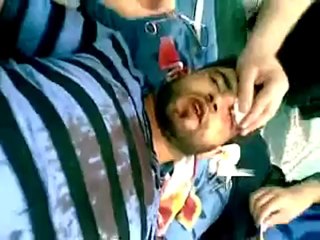 Syria فري برس درعا البلد إحدى الإصابات جراء القصف الشعوائي 9 6 2012 Daraa