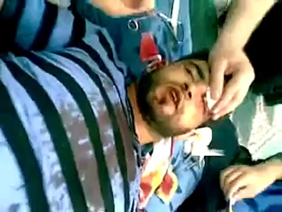 Syria فري برس درعا البلد إحدى الإصابات جراء القصف الشعوائي 9 6 2012 Daraa