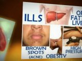 Fatty Liver - Disease Symptoms Causes & Treatments