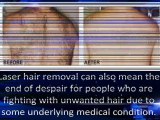 Laser Hair Removal Glebe-Laser Hair Removal