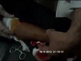 Syria فري برس  ادلب معرة النعمان اصابة المدنيين جراء القصف 10 6 2012 ج1 Idlib
