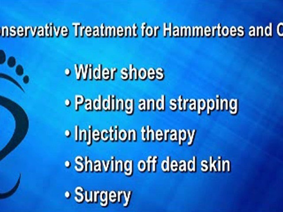 Hammertoes and Corns - Podiatrist in NYC Podiatrist Lower Manhattan - Jerry Leff, DPM