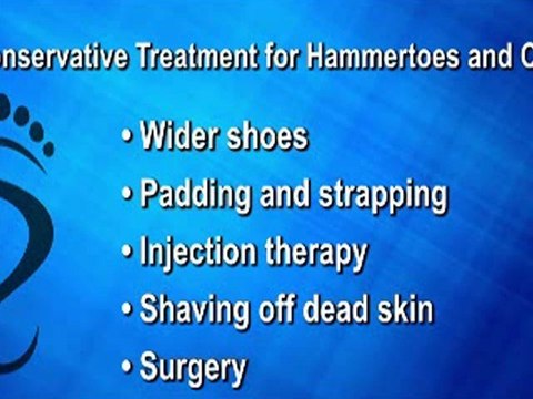 Hammertoes and Corns - Podiatrist in NYC Podiatrist Lower Manhattan - Jerry Leff, DPM