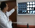 Op. Dr. Umut Yaka ve ekibi tarafından Nusaybin'de ilk kez açık beyin amelyatı yapıldı